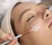 peeling-laser-perawatan-kulit-optimal